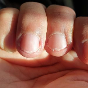 Unhas Sempre Quebrando? Veja 10 Dicas Infalíveis para Fortalecê-las Agora