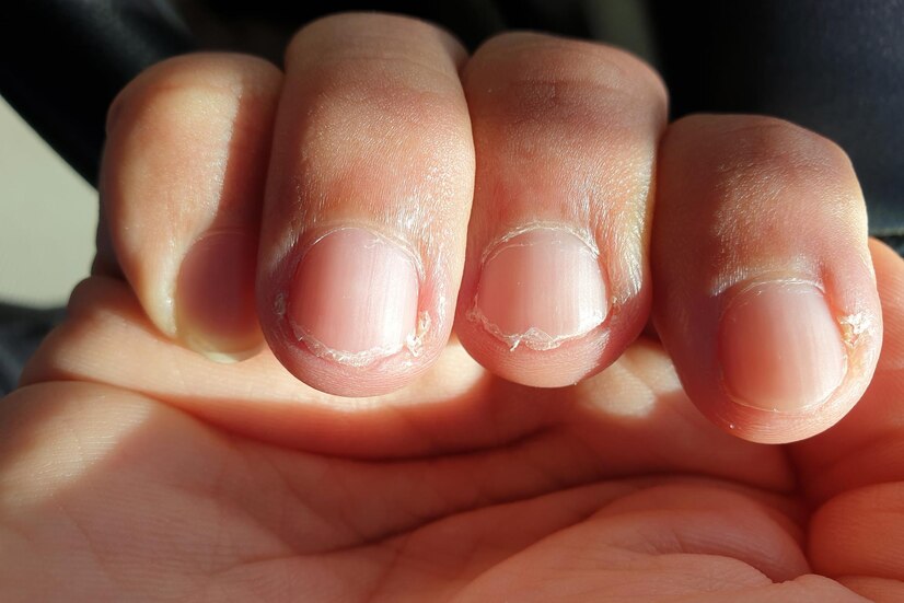 Unhas Sempre Quebrando? Veja 10 Dicas Infalíveis para Fortalecê-las Agora